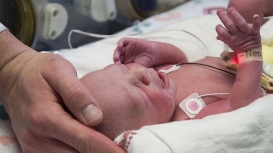 Estados Unidos: nació el primer bebé de un útero trasplantado