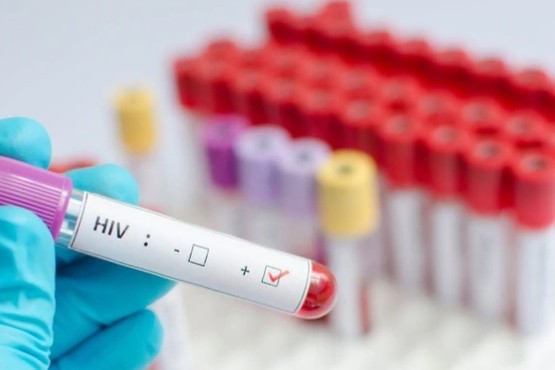 Un estudio francés descubrió una fórmula que permite eliminar el virus del HIV