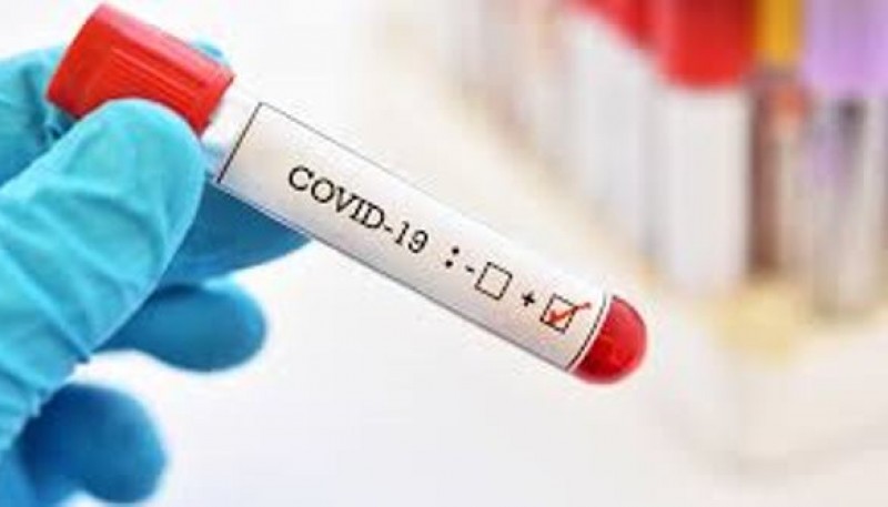 Coronavirus: Se confirmaron 769 nuevos casos de COVID-19