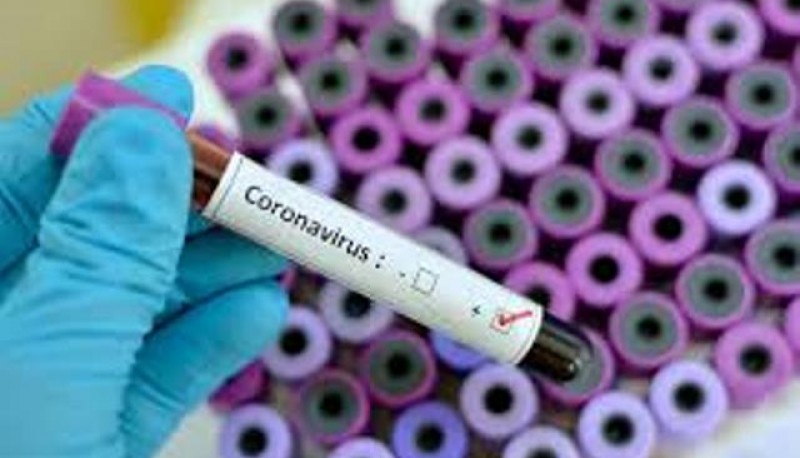 Coronavirus: 1958 casos nuevos y 35 muertes 