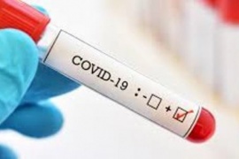 Coronavirus: Hay 148 casos confirmados