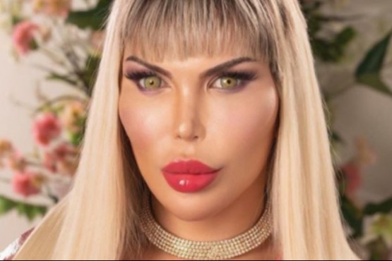 El “Ken humano”, Rodrigo Alves, deslumbra con sus fotos como mujer transgénero