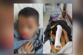 Atropelló a un nene de 4 años y se fugó